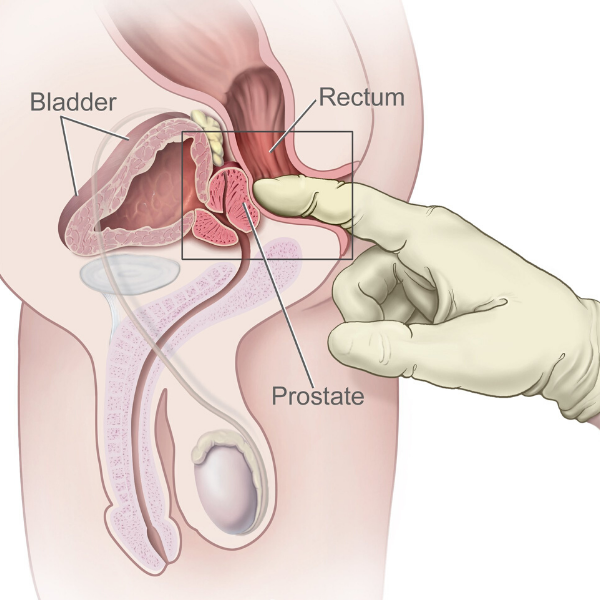 How to Find Your Prostate in Five Minutes Flat